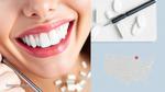 Dental Veneers Cost Guide 2025 Pricing